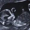 🤰