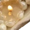 🦪