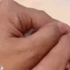 😯