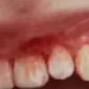 🤩