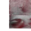 🩸