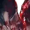 🩸