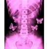 🦋