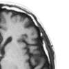 🧠